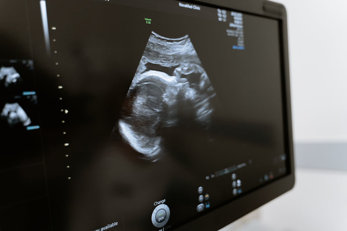 Fetal medicine